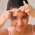 L'acne giovanile, cosa  e come si pu curare